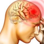 薬を飲まずに偏頭痛やめの奥の痛みを改善する自己流な方法。